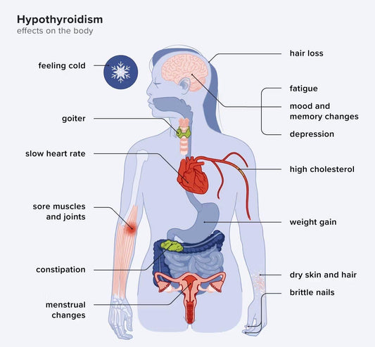 “Why Women With Thyroid Gain Weight Even After Eating Less?”